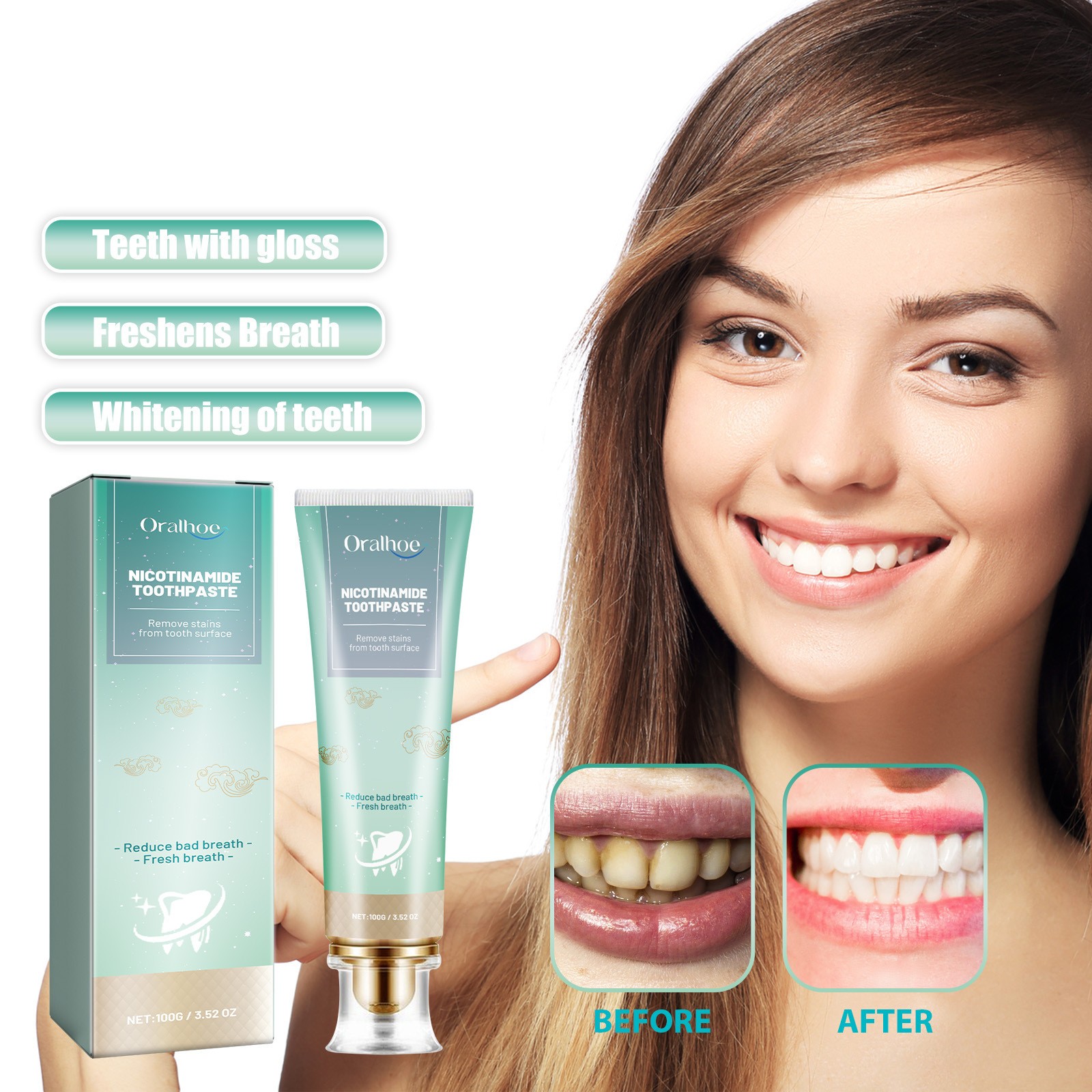 Oralhoe Nicotinamide Toothpaste  Freshen Your Breath, Whiten Your Teeth