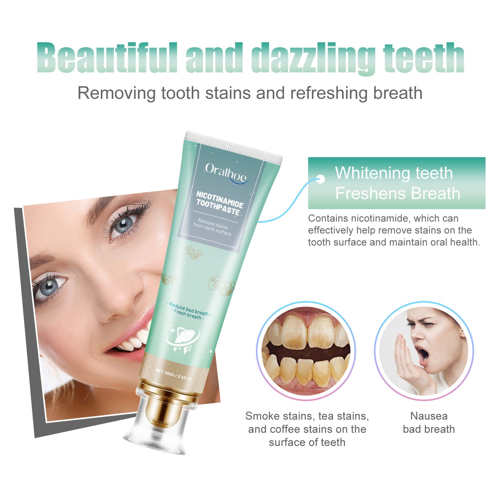 Oralhoe Nicotinamide Toothpaste  Freshen Your Breath, Whiten Your Teeth